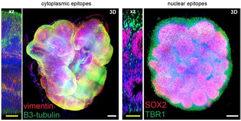 Organoids In 3D Insights For Human Brain Research