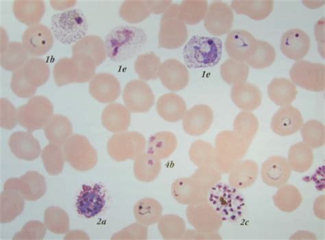 Microbiology Lab Practical Flashcards Quizlet