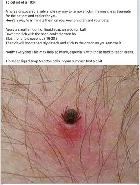 How To Get Rid Of A Tick Useful Life Hacks Simple Life Hacks Tick