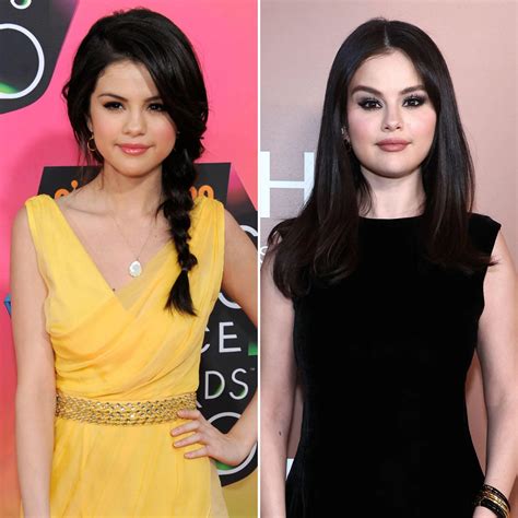 Selena Gomez Plastic Surgery The Truth Behind Rumors