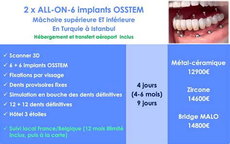 Refaire Ses Dents Exemples D Taill S Prix