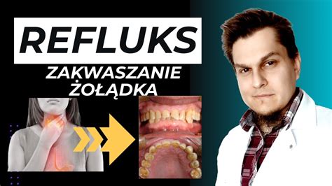 Refluks Zgaga Zakwaszanie O Dka Skuteczny Spos B Na Refluks