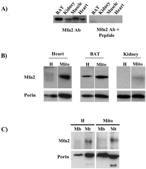 Mfn Is Abundantly Expressed In Muscle And Induced During Myogenesis