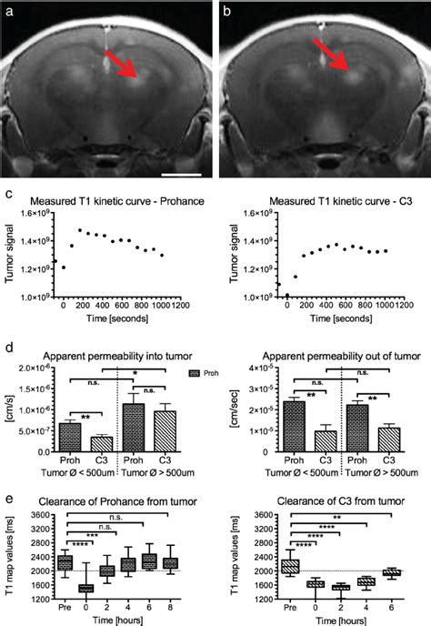 Evaluation of tumor kinetics by T1w MRI with Prohance or C3 contrast ...