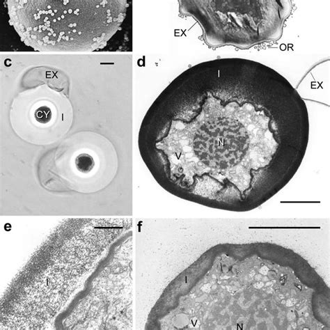 Pdf Immunocytochemical Localization Of Cry J 1 The Major Allergen Of Cryptomeria Japonica