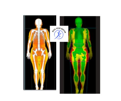 Boston DEXA Scan Testimonials Hear From Satisfied Clients DEXA Scan