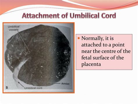 Ppt Fetal Membranes Powerpoint Presentation Free Download Id2652392