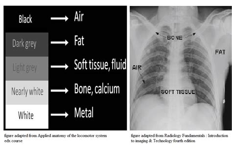 X Ray Radiography Diagram