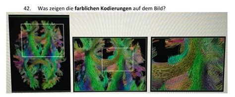 Neuro Offene Fragen Karteikarten Quizlet