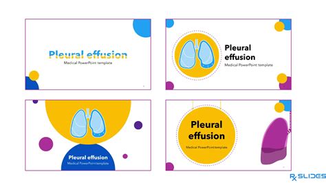 Download Pleural Effusion Powerpoint Template Rxslides