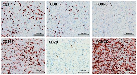 Representative Examples Of Hematoxylin Eosin Immunohistochemical