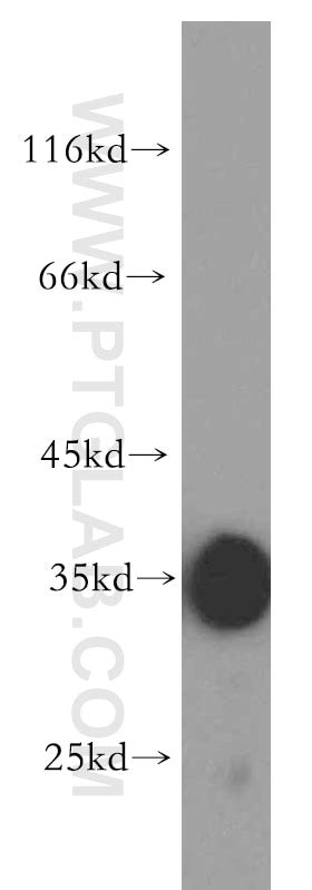 Fstl1 Antibody 20182 1 Ap Proteintech