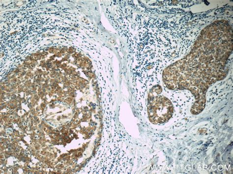 Apc Antibody Ap Proteintech