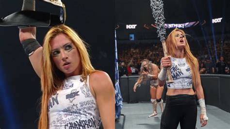 Becky Lynch Displays Gruesome Injury She Suffered At No Mercy Breaks