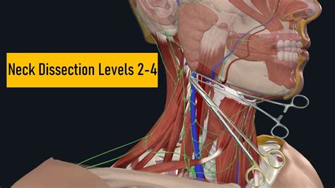 Surgery Neck Dissection 2 To 4 Levels Safe Techniques For Beginner