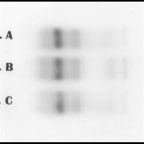 Hemoglobin Electrophoresis Download Scientific Diagram