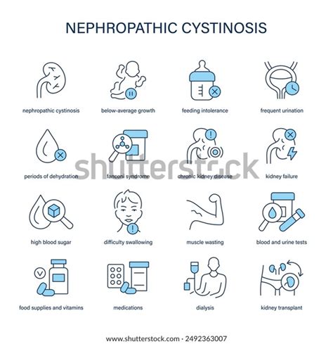 Nephropathic Cystinosis Symptoms Diagnostic Treatment Vector Stock ...