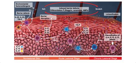 Pathophysiology Of Atopic Dermatitis A Nonlesional Skin With