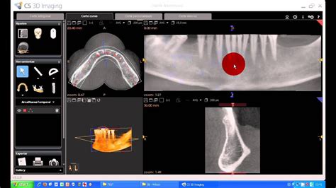 Tutorial Cs D Imaging Software Carestream Corte Curvo Arcada