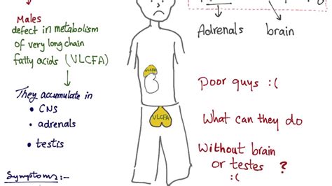 Lysosomal Storage Disease Mnemonics | Dandk Organizer