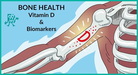 Bone Health, Vitamin D & Biomarkers | Biomedica