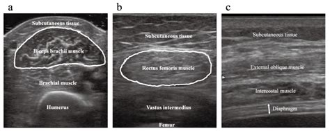 Typical Ultrasonographic Images Of Upper Limbs Lower Limbs And