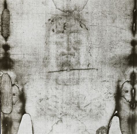 Photographs of the Shroud of Turin – F.I.A.M.C.