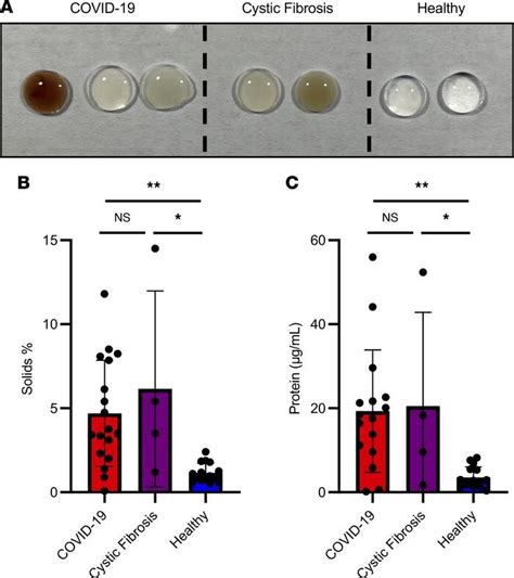 Scientists decipher the danger of gummy phlegm in severe COVID-19