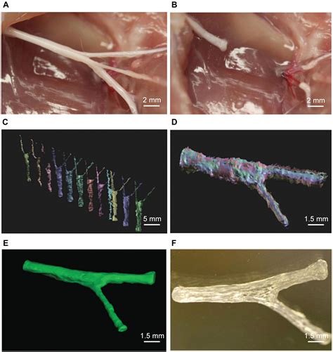 Frontiers Additive Manufacturing Of Nerve Guidance Conduits For