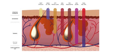 good laser treatment  pigmentation  melasma