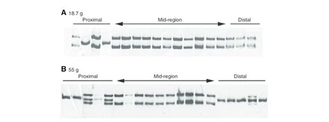 Myosin Heavy Chain MHC Isoform Expression As A Function Of Anatomical