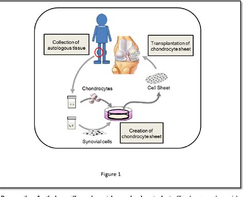 Figure 1 From Application Of Chondrocyte Sheets For Cartilage