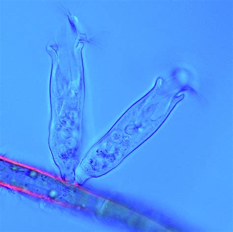 Ciliate Protozoa Photograph by Marek Mis - Fine Art America