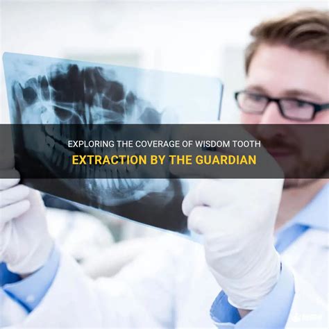 Exploring The Coverage Of Wisdom Tooth Extraction By The Guardian MedShun