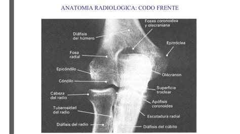 Entender Mal Productos L Cteos Lugar De Nacimiento Rx Codo Adjuntar A