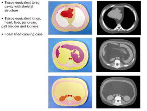 3d Sectional Torso Phantom Includes 12 Internal Organ Tissues Sold By Supertech