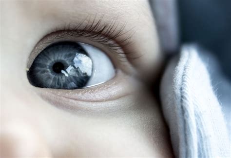 Congenital Nystagmus In Infants Reasons Symptoms Treatment