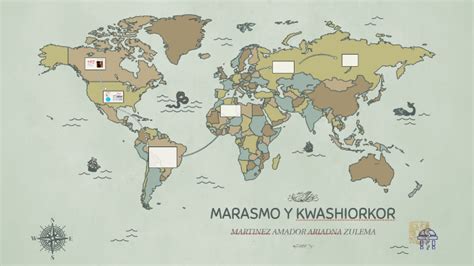 Marasmo Y Kwashiorkor By Ariadna Amador On Prezi