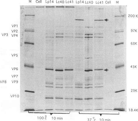 35s Methionine Labeled Proteins Of Cells Infected With Rotaviruses