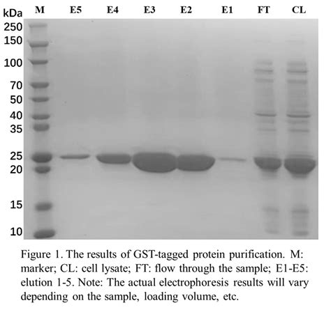 APExBIO - GST-tag Protein Purification Kit