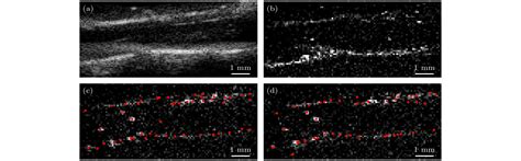 Ultrafast Ultrasound Localization Microscopy Method For Spinal Cord