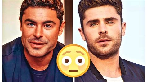 Zac Efron Aparece Con Un Nuevo Rostro ¿tuviste Alguna Cirugía Plástica