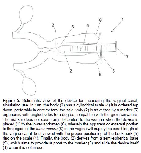 Measurement Of Vaginal Flexibility And Its Involvement In The Sex