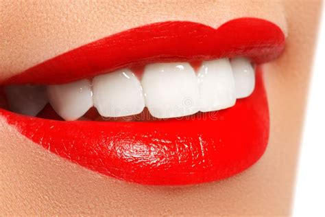 Sorriso Saudável Dentes Que Whitening Conceito Dos Cuidados Dentários