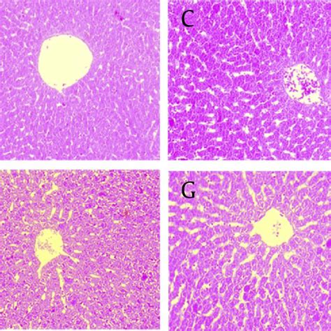 Photomicrographs Of Liver Section Stained With Hematoxylin And Eosin