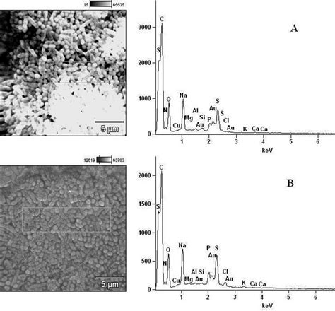 Elemental Components Of A Extract Untreated S Aureus And B