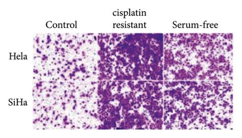 Cervical Cancer Stem Like Cells Hold Superior Migration And Invasion Download Scientific