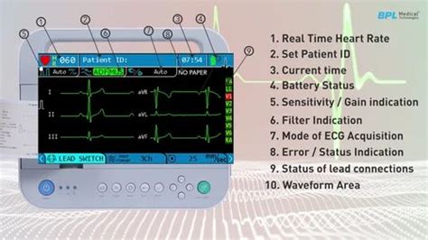 Bpl Cardiart Genx Channel Ecg Machine Digital At Rs In Surat