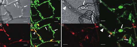 Nucleic Acid Staining Of Hyphae Of E Vermicola Cbs Using