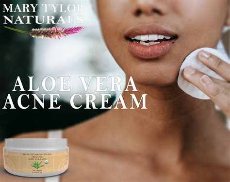 Diy Acne Aloe Vera Gel Cream Mary Tylor Naturals